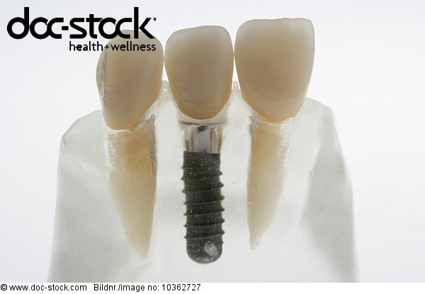 Background,Behandlung,Behandlung Zahnbehandlung Zahn,Bundesland,Bundesrepublik Deutschland,clippable