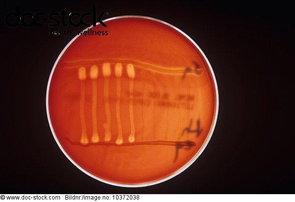 a-listeria-bacteria-camp-test-in-a-petri-dish-rights-managed-image