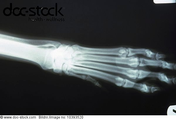 x ray of kitten paw