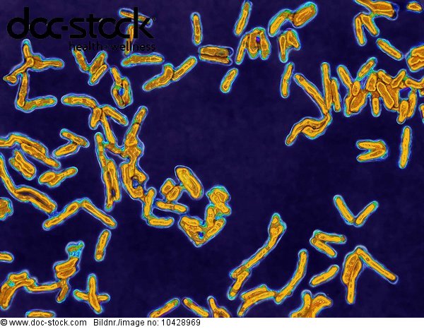 Diptheria bacillus (corynebacterium diphteriae or KlebsLoeffler